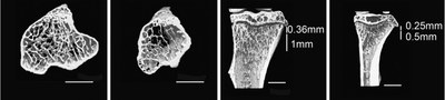 bone phenotyping