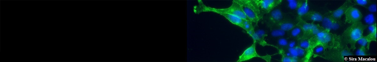 https://www.sfr-biosciences.fr/plateformes/cellular-and-dna-technologies/Cellulonet/Cellulonet/leadImage